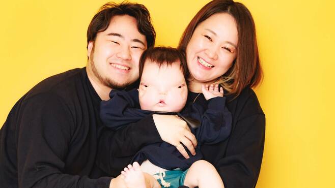 ｢まぶた欠損｣1歳息子をYouTube配信､両親の決断