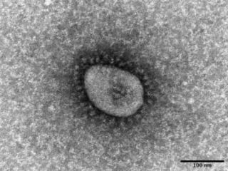 米、コロナ後遺症に定義　「症状3カ月」共通化図る